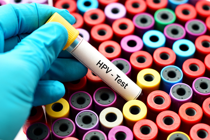 Are there different types of HPV tests?